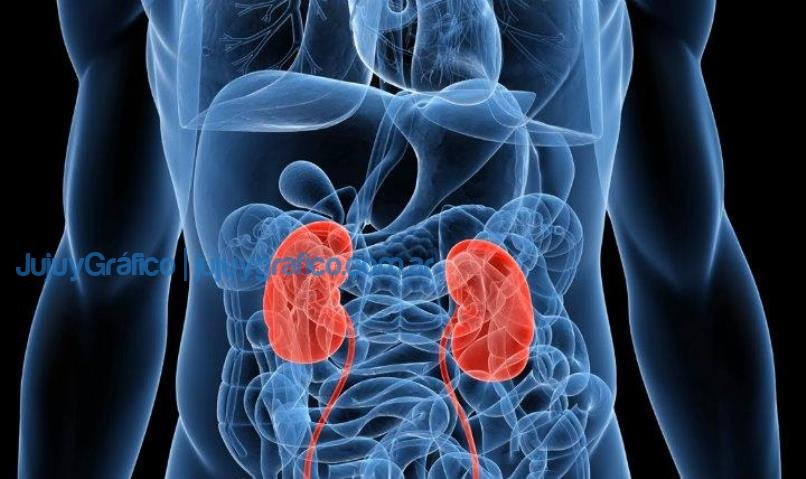 Cancer Renal