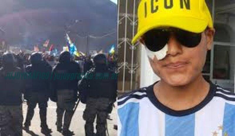 Críticas a la imputación de lesiones leves en la represión de Purmamarca 03 Críticas a la imputación de lesiones leves en la represión de Purmamarca 03