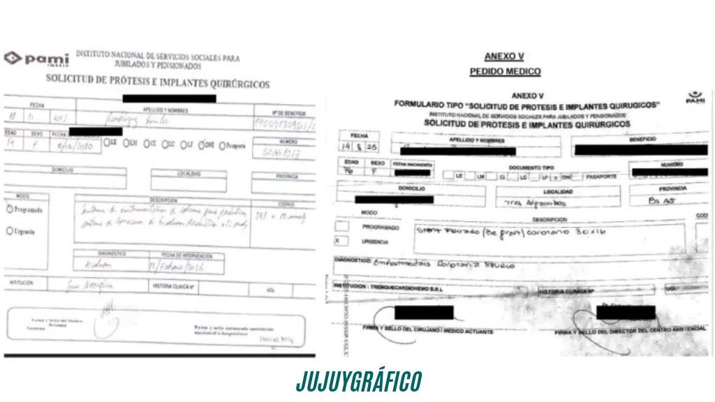 PAMI expone historias clínicas de jubilados en Jujuy y el Gobierno inyecta $580.000 millones 03